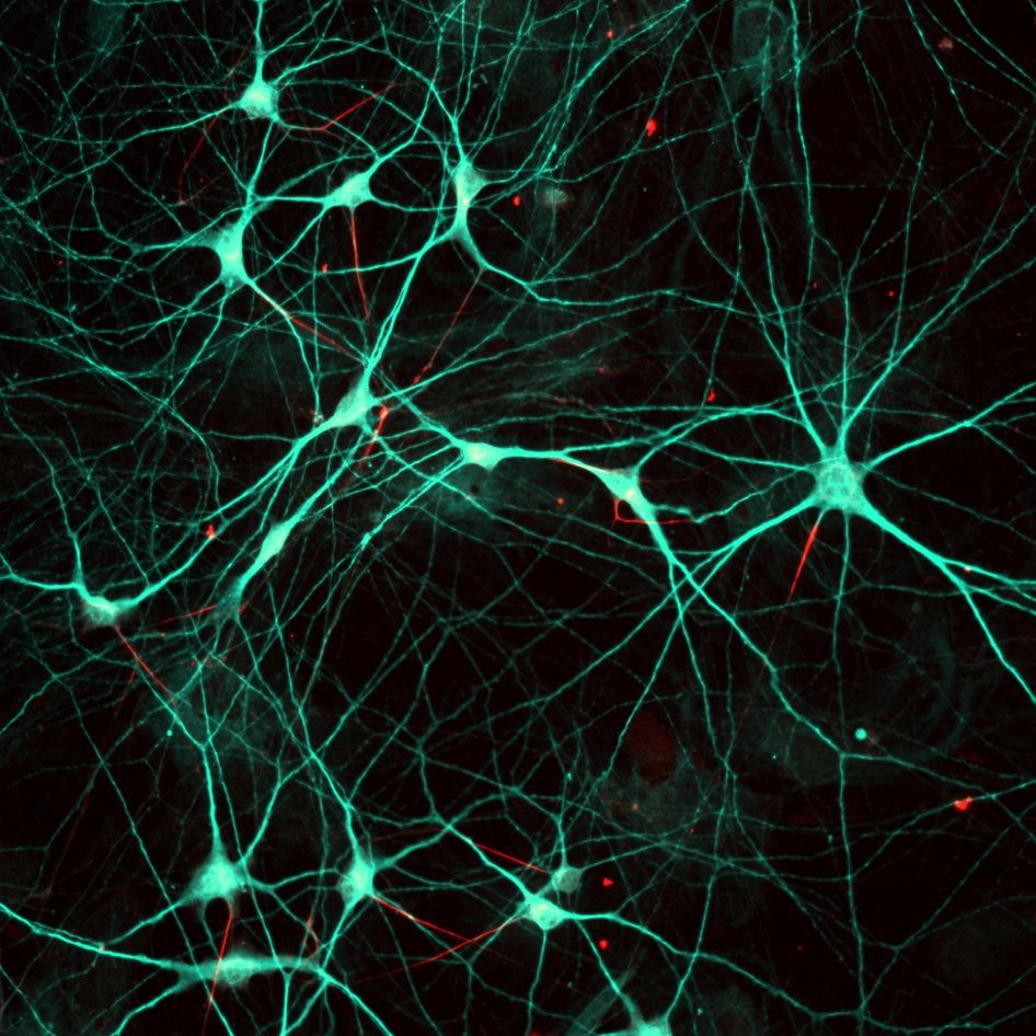 Axon initial segment (red) in human stem cell-derived neurons (green)